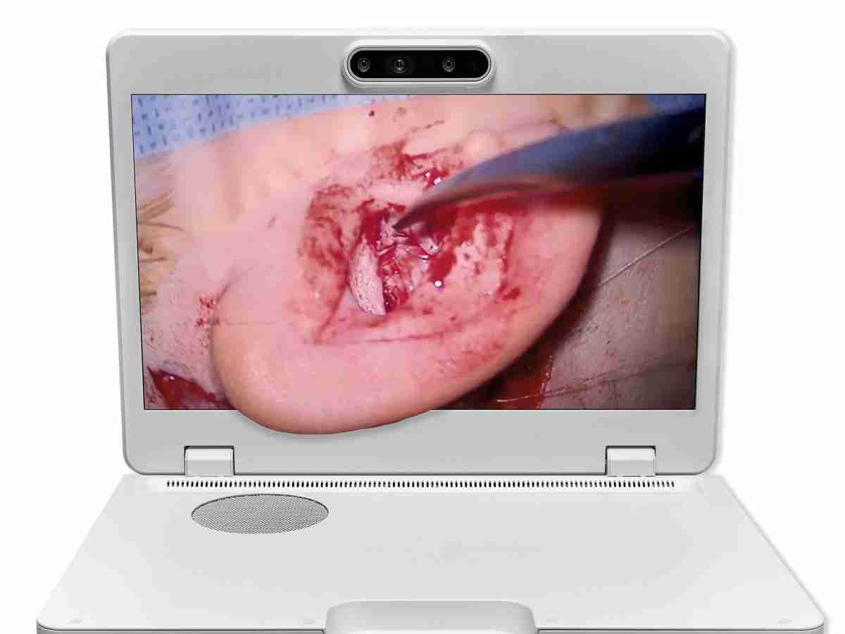 达擎之＂Heads-up 3D显微手术显示系统＂，，整合4K裸眼3D显示及眼球追踪系统，，，具备快速追踪人眼移动位置功能，，，，减轻医师长时间维持固定姿势的负担，，，让医师能有更宽广清晰的3D立体视野及更舒适的姿势来执行手术。。。。